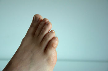 Corns Treatment Corns Treatment in the Kings County, NY: Brooklyn, Queens County, NY: Queens, Long Island City, Flushing, Jamaica, Astoria, Elmhurst, Ridgewood, New York County, NY: Manhattan, Bronx County, NY: Bronx, Richmond County, NY: Staten Island areas