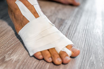 Foot Fractures treatment in the Kings County, NY: Brooklyn, Queens County, NY: Queens, Long Island City, Flushing, Jamaica, Astoria, Elmhurst, Ridgewood, New York County, NY: Manhattan, Bronx County, NY: Bronx, Richmond County, NY: Staten Island areas
